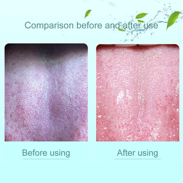 1 Piece Tongue Cleaner / Reduce Bad Breath