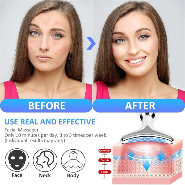 Es-1081 Massager Intense Pulsed Light Wrinkles Reducing Instrument – Esx – Anti Ageing & Reduces Puffiness | Face Massager For Fine Line & Wrinkles – Random Color